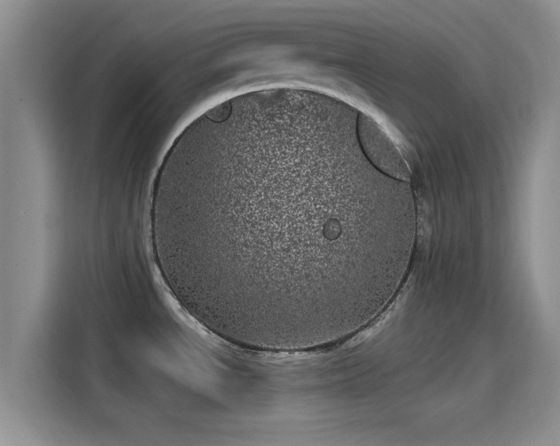 X0000114201534200910161215