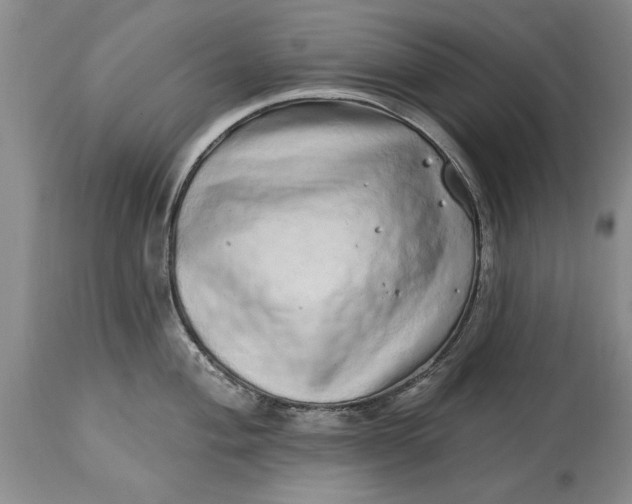 X0000114201004200910231339