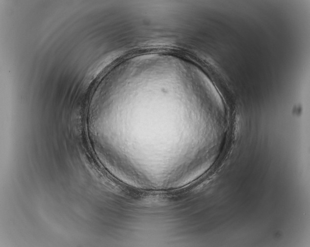 X0000114201162200910231337