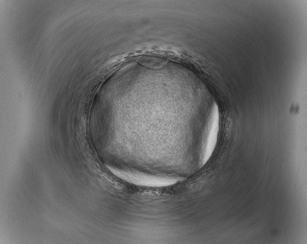 X0000114201489200910231331