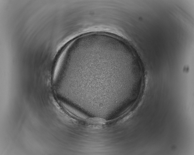 X0000114201505200910231332