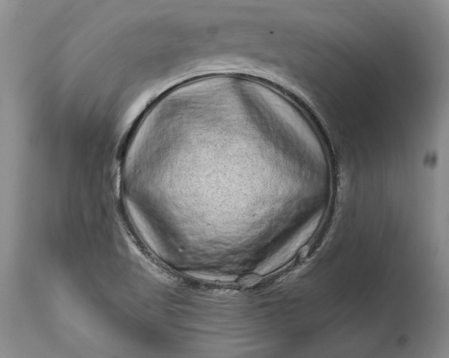 X0000114201509200910231332