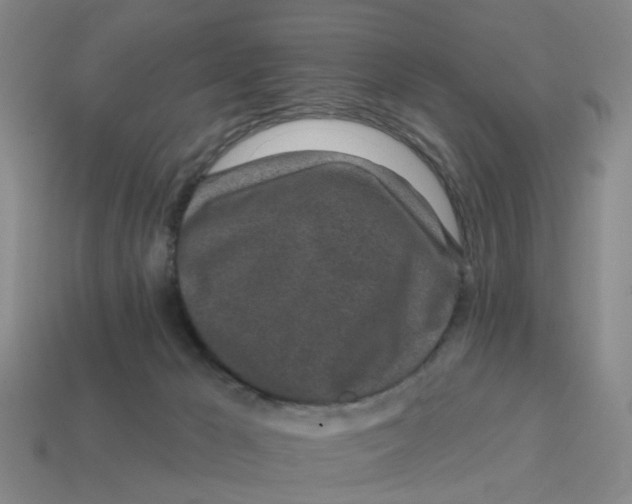 X0000114200029200911061433