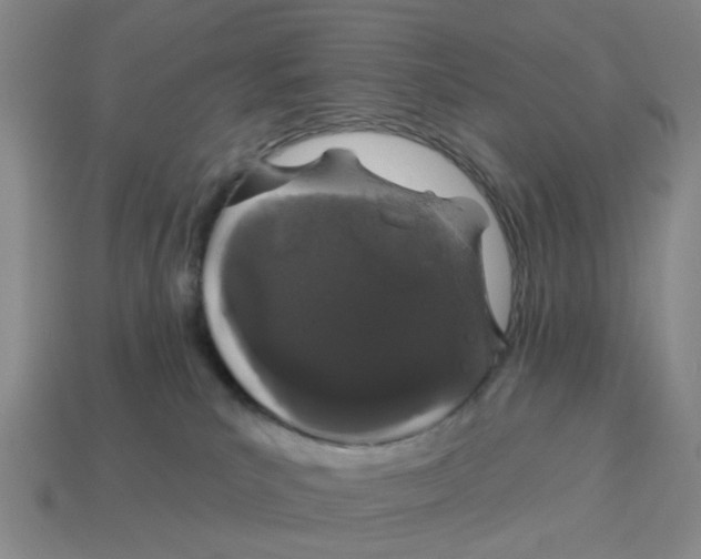 X0000114200039200911061433