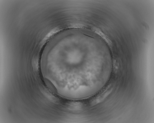 X0000114200203200911061431