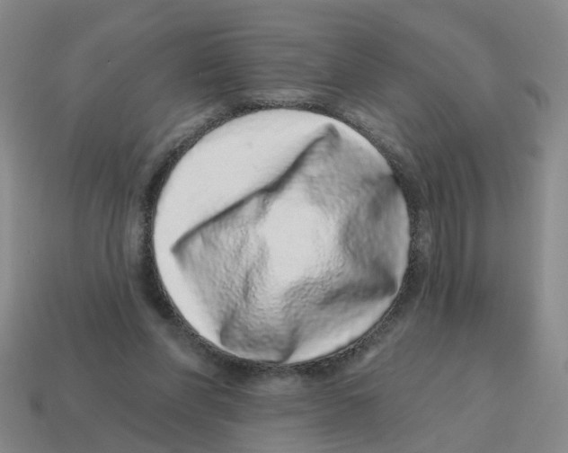 X0000114200206200911061431