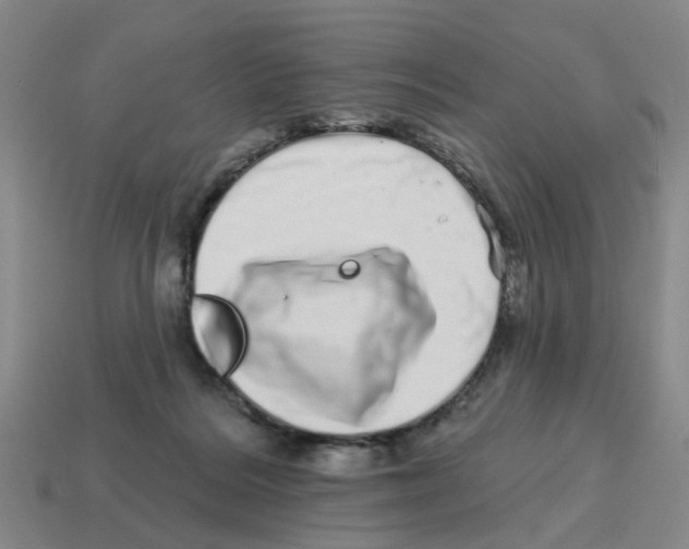 X0000114200220200911061431