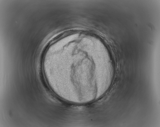 X0000114200247200911061430