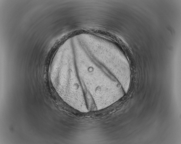 X0000114201016200911061420