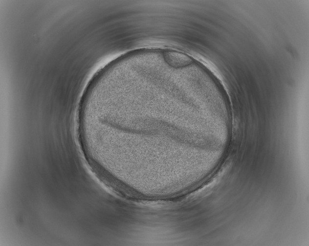 X0000114201045200911061420