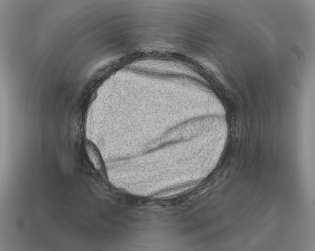 X0000114201063200911061420