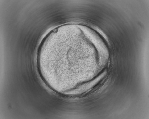 X0000114201099200911061419