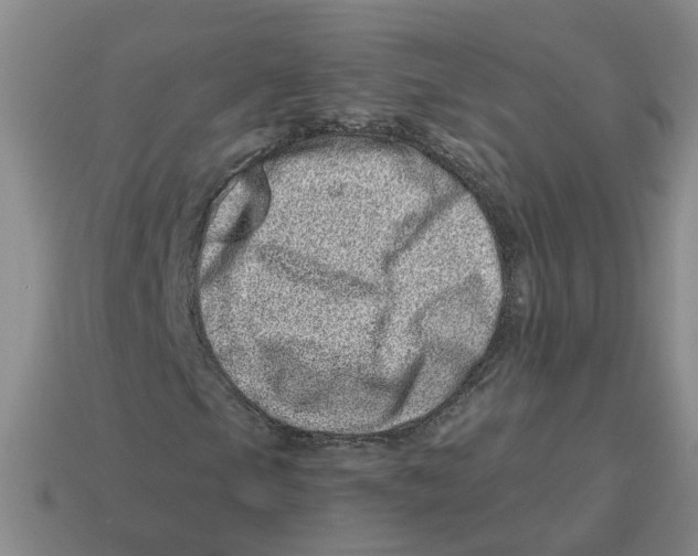 X0000114201105200911061418