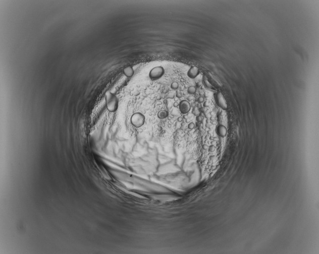 X0000114201106200911061418