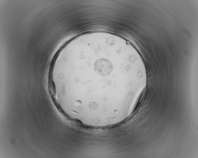 X0000114201139200911061419