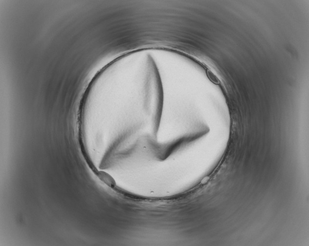 X0000114201143200911061419