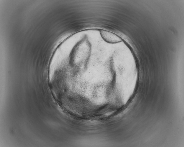 X0000114201145200911061419