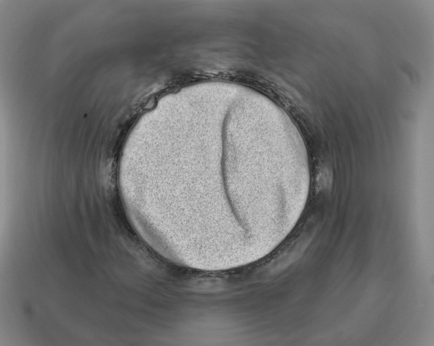 X0000114201156200911061418