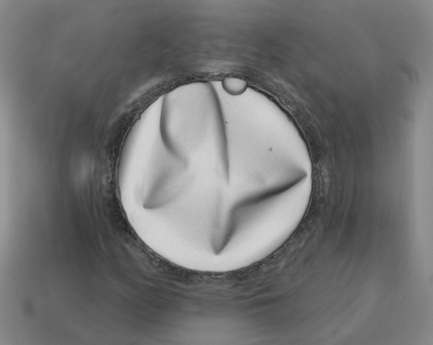 X0000114201158200911061418