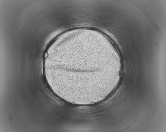 X0000114201171200911061418