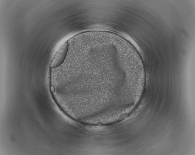 X0000114201387200911061415