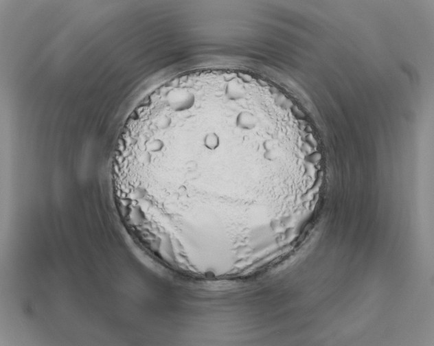 X0000114201425200911061415