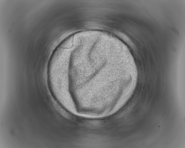 X0000114201431200911061415