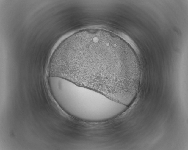 X0000114201436200911061415