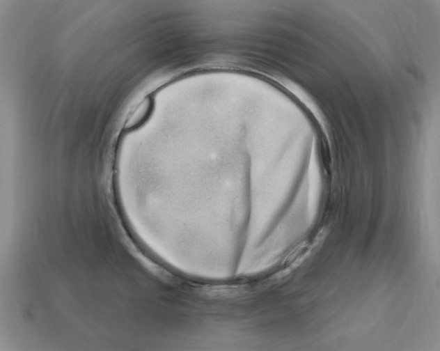 X0000114201437200911061415