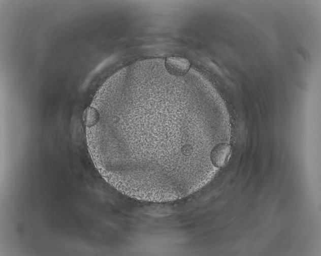 X0000114201446200911061414