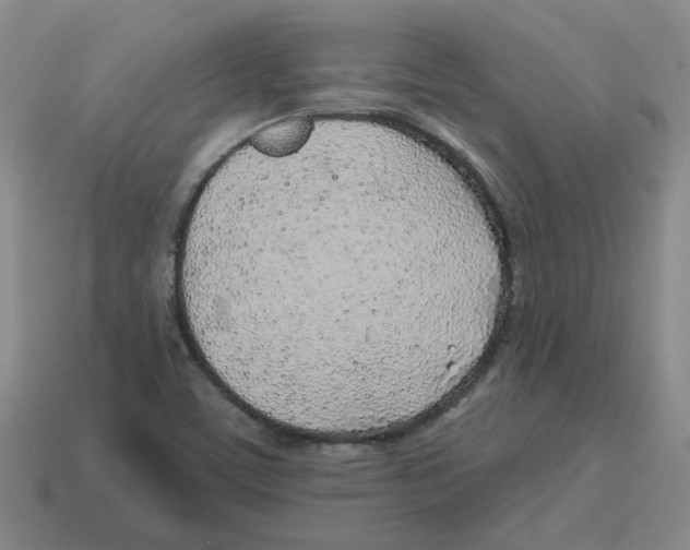 X0000114201459200911061414