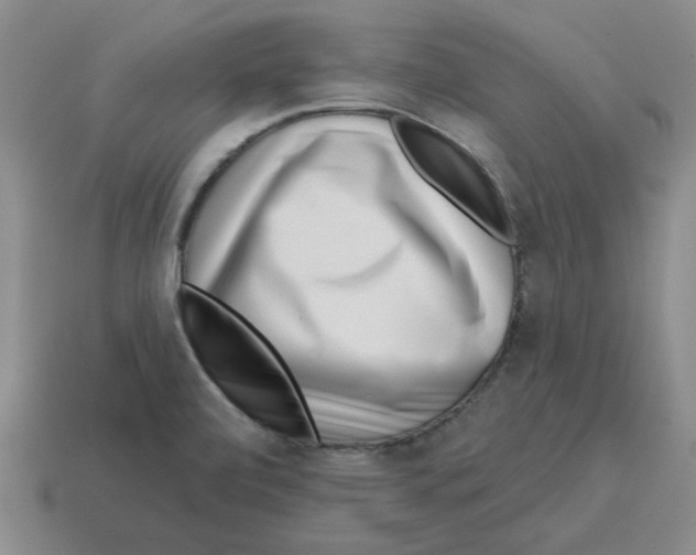 X0000114201472200911061414