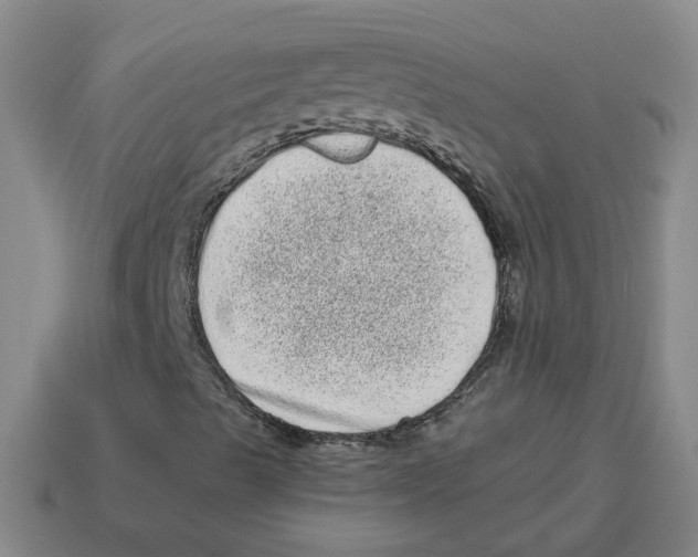 X0000114201489200911061413