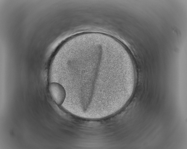 X0000114201503200911061413