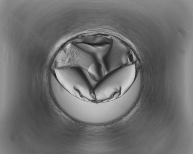 X0000114201506200911061413