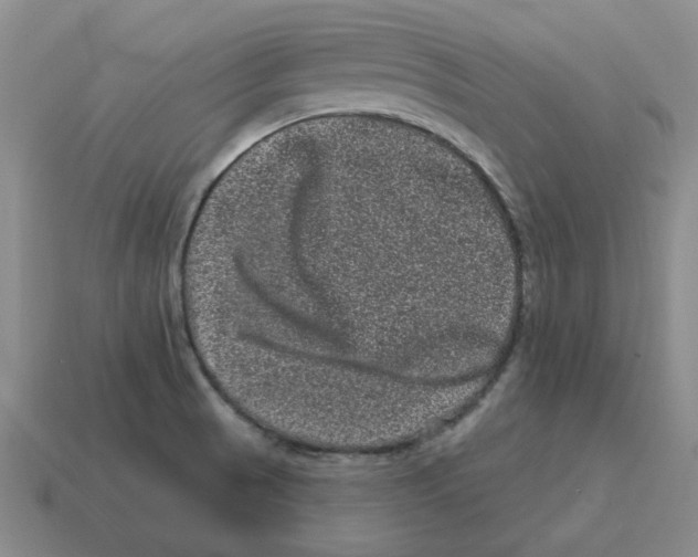 X0000114201521200911061413