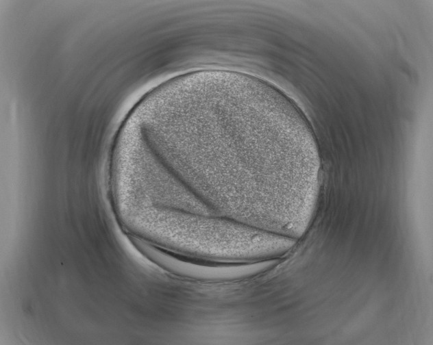 X0000114201531200911061413