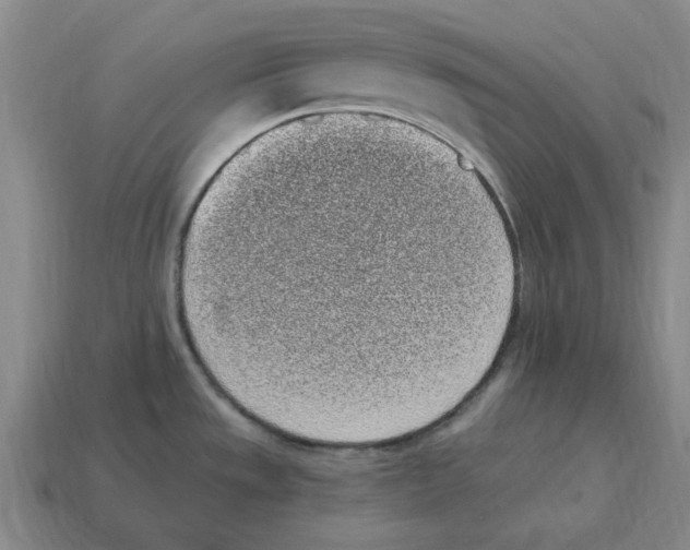 X0000114201533200911061414