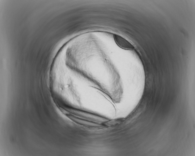 X0000114201535200911061414