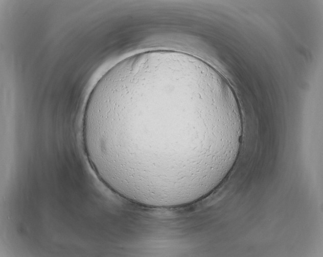 X0000114201536200911061414