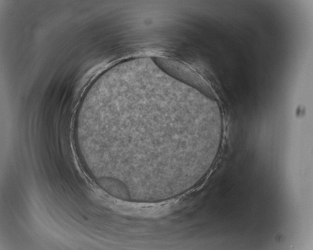 X0000114200001200911201011