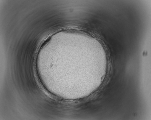 X0000114200049200911201009