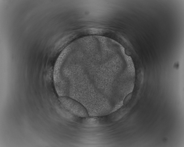 X0000114200325200911201006