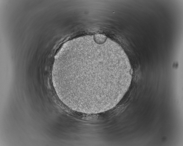 X0000114201201200911200952