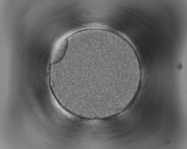 X0000114201387200911200949