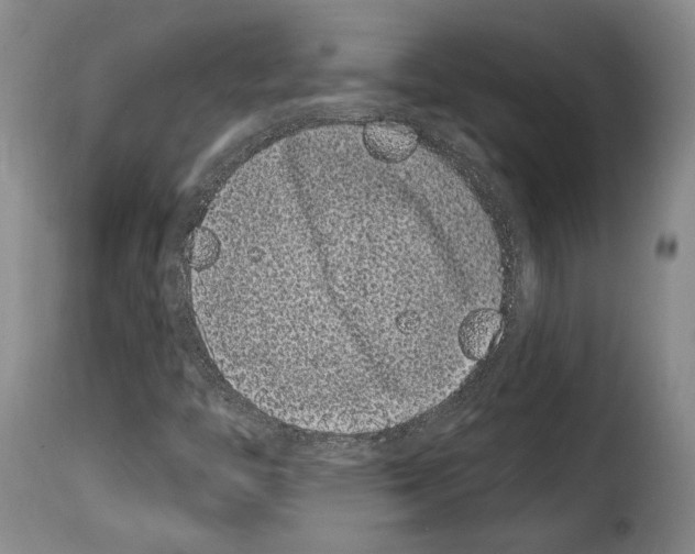 X0000114201446200911200948