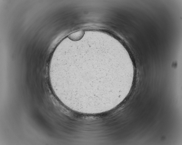 X0000114201459200911200948