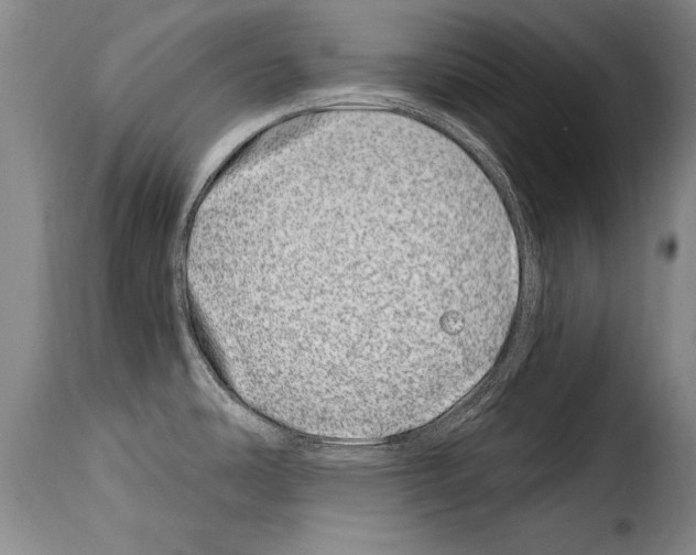 X0000114201486200911200948