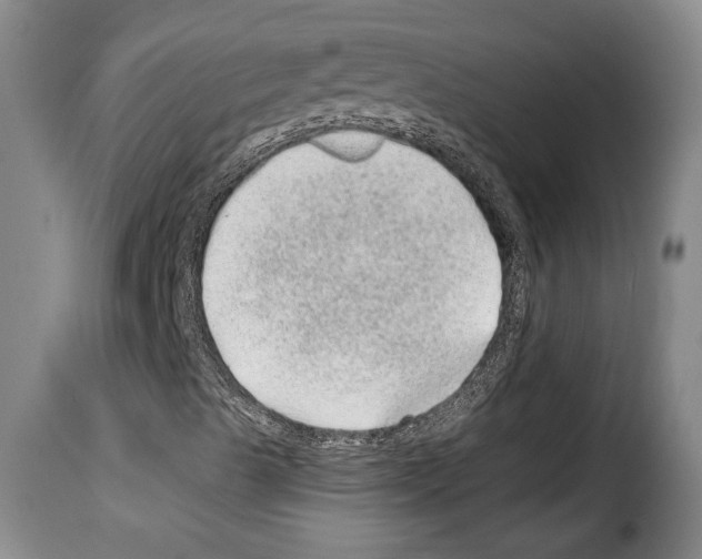 X0000114201489200911200947