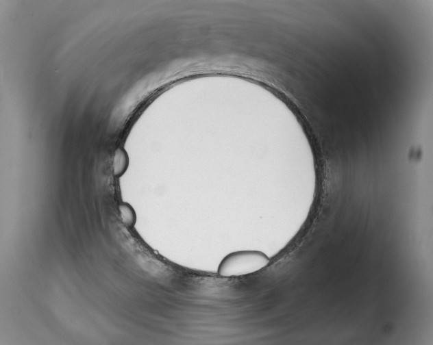 X0000114201499200911200947